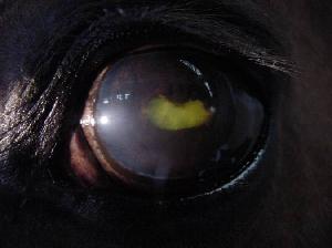 Uveitis